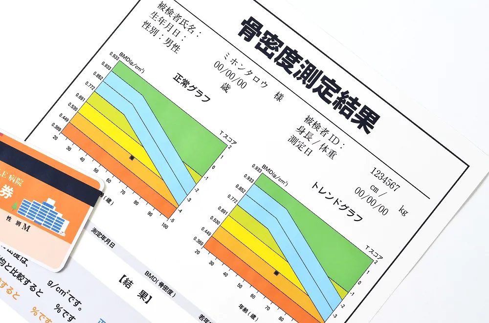 骨密度検査（DXA法）