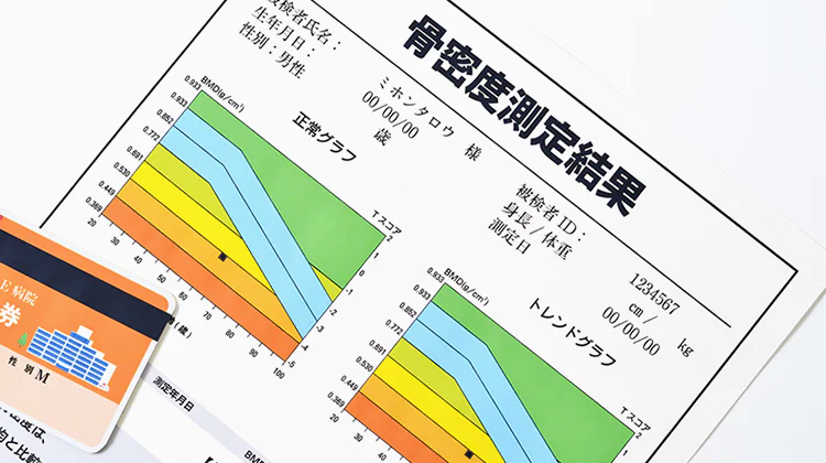 骨の量を調べる骨密度検査に対応