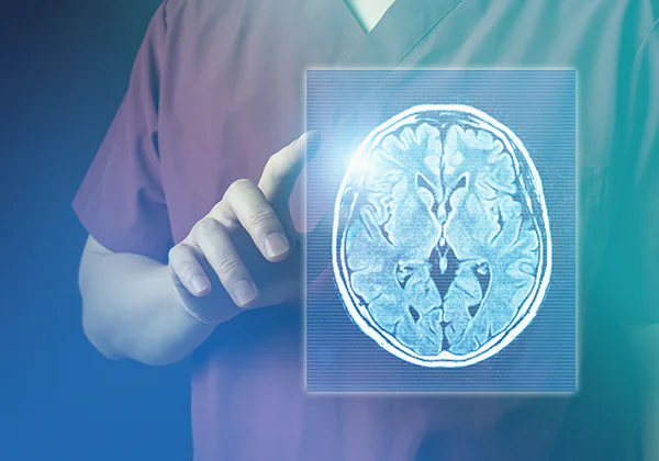 脳の病気の予防、早期発見のための脳ドック