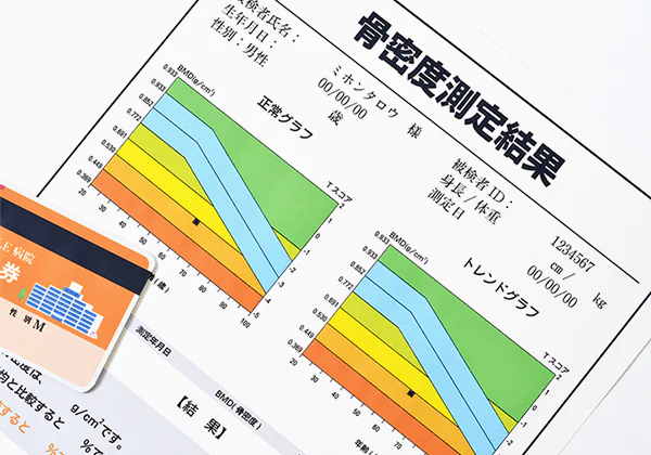 骨の量を調べる骨密度検査に対応